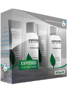 Exposed Skincare Review