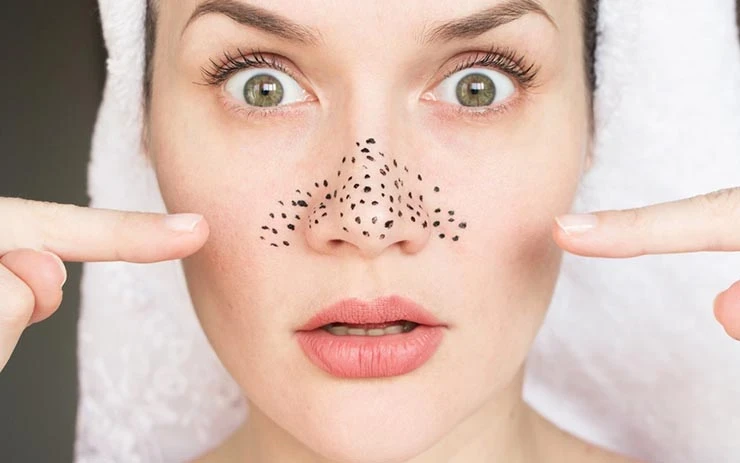 Anti-Aging Serum for Oily Skin